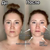 Студия моделирования лица и тела Vtrende фото 6